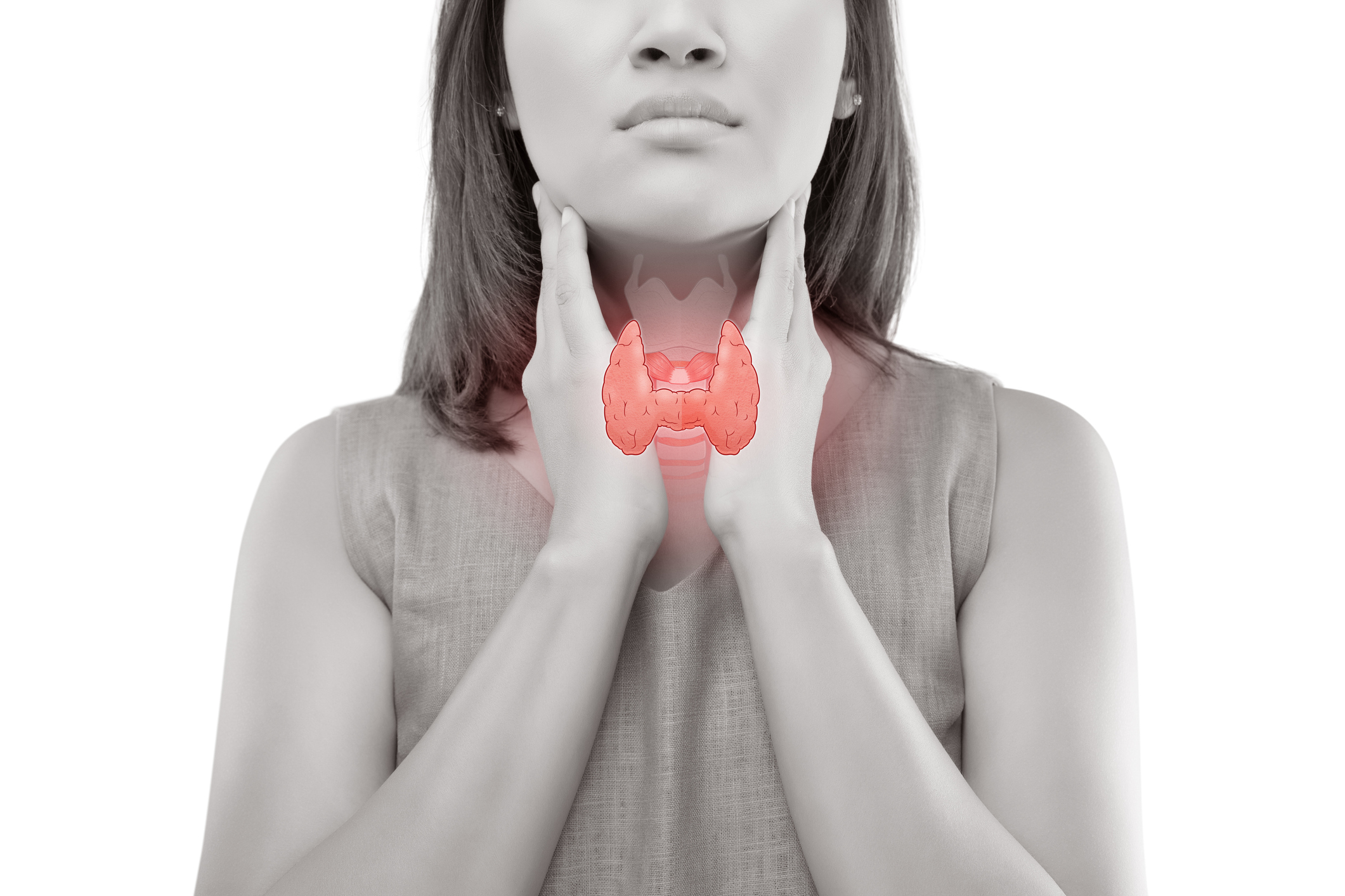 Thyroid ophthalmopathy (or dysthyroid orbitopathy)